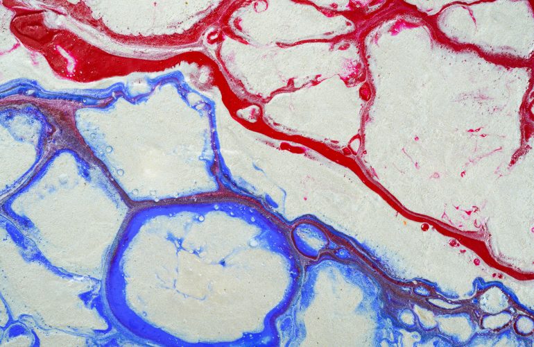 prevencion de las enfermedades venosas