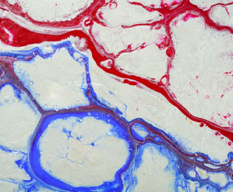 prevencion de las enfermedades venosas