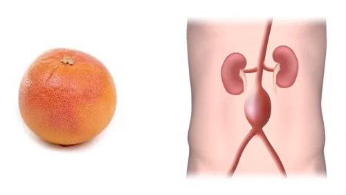Einstein y el original tratamiento de su aneurisma de aorta