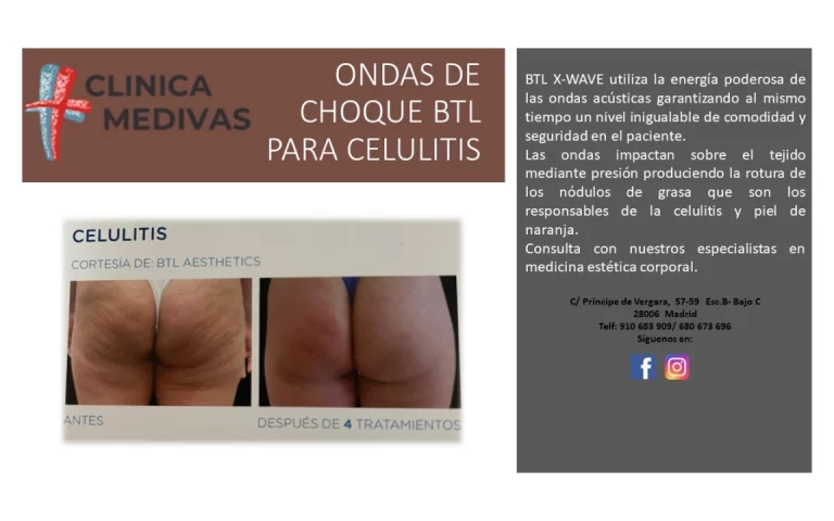 Diseño sin título (4)