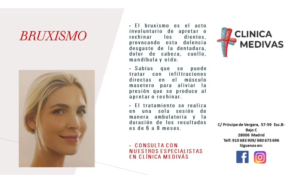 bruxismo tratamiento medivas