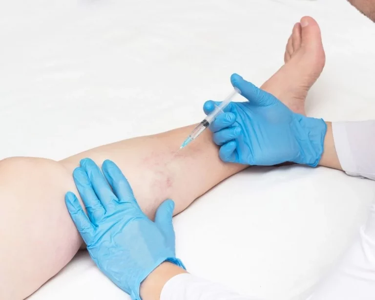 Tratamiento de varices clinica medivas madrid y valladolid