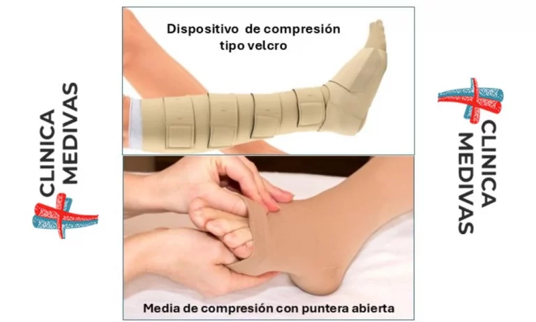 Enfermedades Venosas Después del verano Entrevista Dr. Arroyo