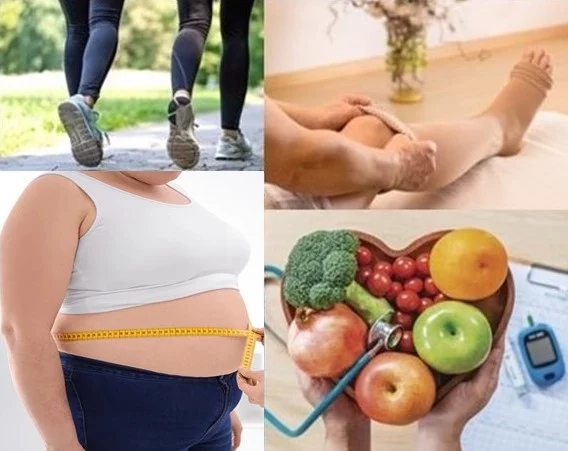 Why reaparecen las varicose veins? | Clínica Medivás Madrid HABITOS SALUDABLES VARICES 3